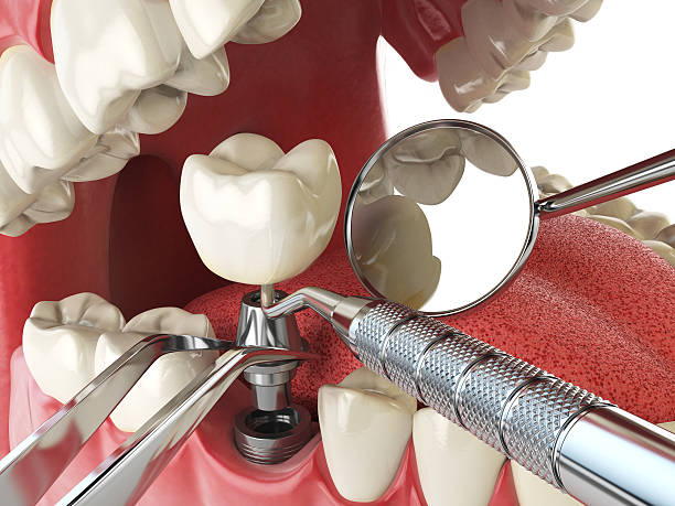 Best Emergency Treatment for Dental Infections or Abscesses in Hellertown, PA